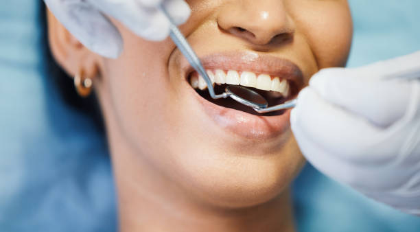 Best Emergency Dentist for Lost Fillings or Crowns in Dalton Gardens, ID