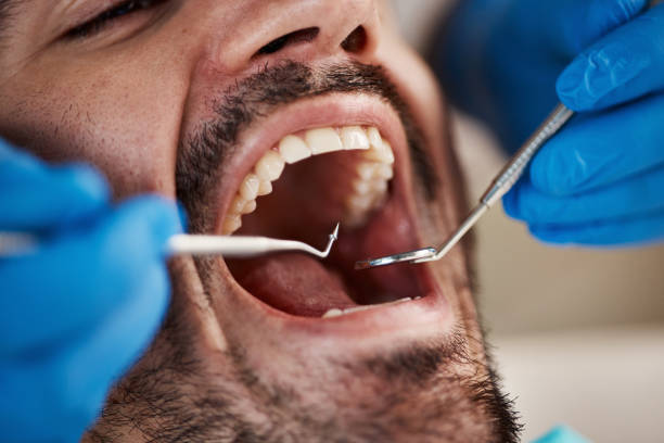 Best Urgent Dental Care for Toothache in Dalton Gardens, ID