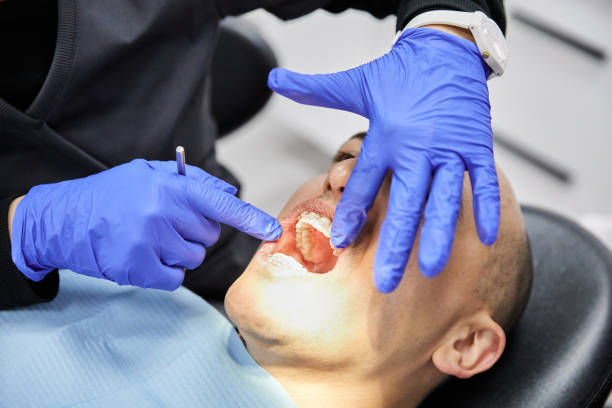 Best Emergency Dental Extractions in Dalton Gardens, ID