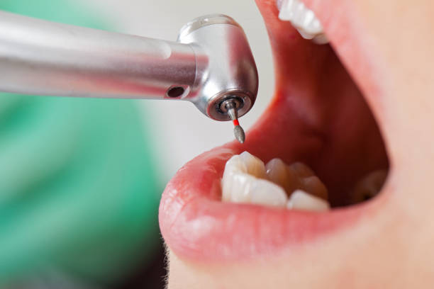 Best Orthodontic Emergency Dentist in Dalton Gardens, ID